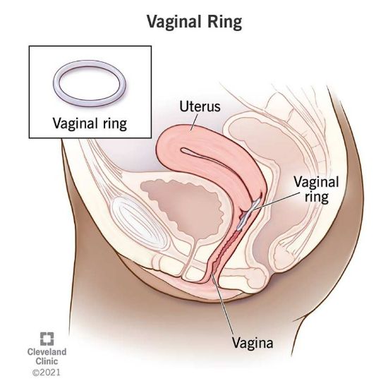 Picture of NUVARING VAGINAL RING